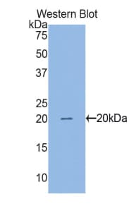 BIRC5 / Survivin Antibody (aa1-142, FITC)