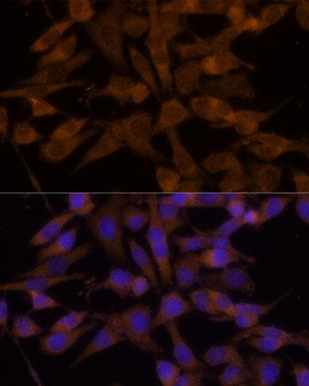 UGT2B7 Antibody