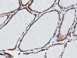 OGFOD1 Antibody (clone OTI1F4, Carrier-free)