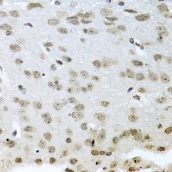 Polyclonal Rabbit anti-Human IMP-3 / IGF2BP3 Antibody (IHC, WB)