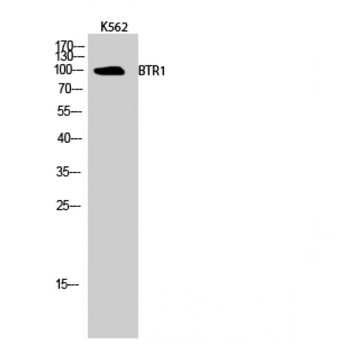 SLC4A11 / NABC1 Antibody (260-340 aa, Internal)