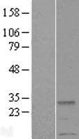 METTL2A Protein (Over-Expression Lysate Myc-DDK (Flag))