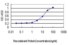 GABBR1 / GABA B Receptor 1 Antibody (clone 2D7)