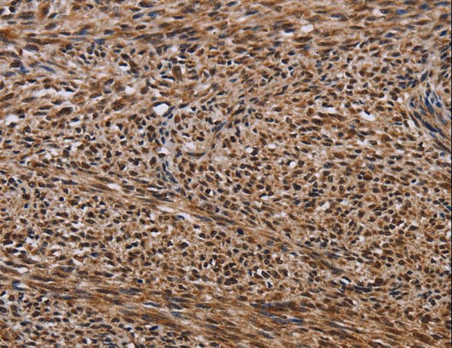 Polyclonal Rabbit anti-Human KIF1C Antibody (IHC, WB)