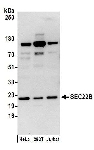 SEC22B Antibody (aa100-150)