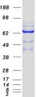 Human GMPS / GMP Synthase Protein (Recombinant Myc-DDK (Flag))