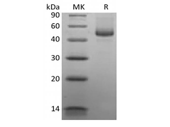 Human CD27L / CD70 Protein (Recombinant Mouse IgG Fc, C-terminus)
