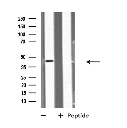BMP12 / GDF7 Antibody