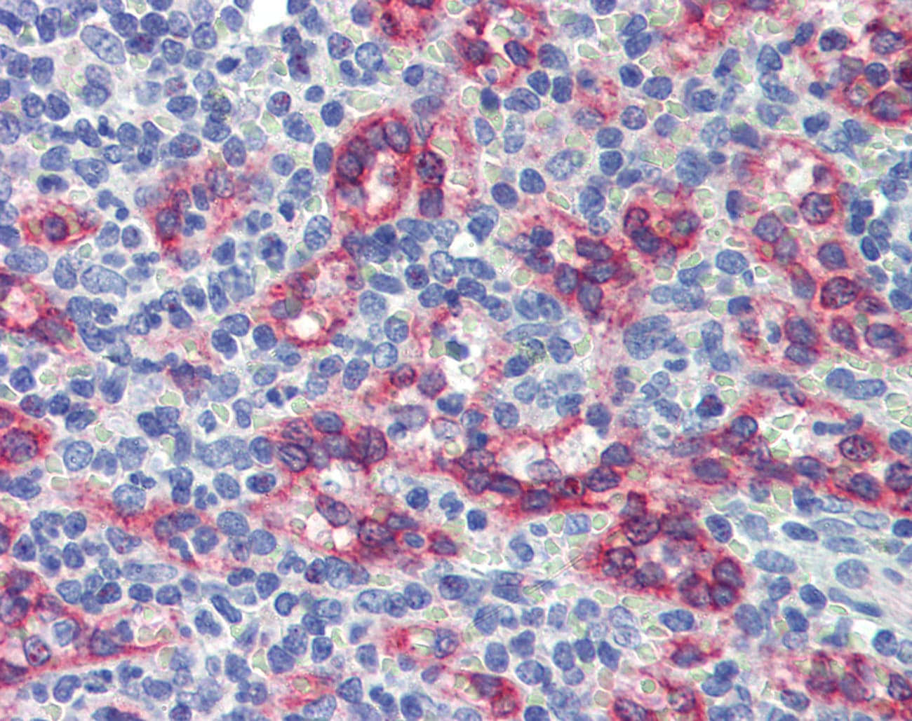 Polyclonal Rabbit anti-Human ZNF71 Antibody (C-Terminus, IHC, WB)