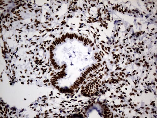 HNRNPH1 / hnRNP H Antibody (clone OTI4F10)