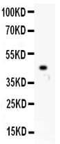 ZEB2 / SIP-1 Antibody (aa1-200)