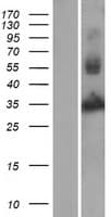Human YKL39 / CHI3L2 Protein (Over-Expression Lysate Myc-DDK (Flag))