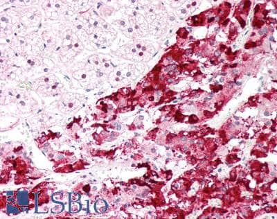 SLC6A2 / NET Antibody