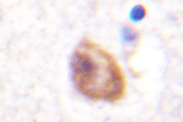 Polyclonal Rabbit anti-Human DDX3 / DDX3X Antibody (Leu318, IHC, WB)