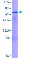 Human TDP2 / TTRAP Protein (Recombinant GST)