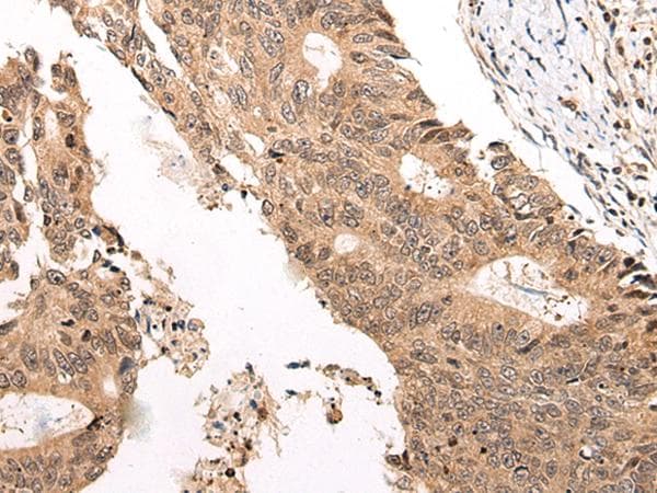 Polyclonal Rabbit anti-Human C13orf8 / ZNF828 Antibody (IHC)