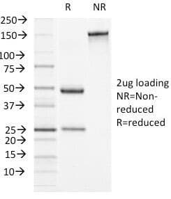 Alpha-1-Antichymotrypsin Antibody (clone AACT/1451)