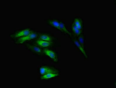Polyclonal Rabbit anti-Human SLITRK5 Antibody (IHC, IF, WB)