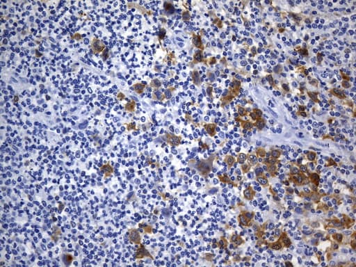 CD30 Antibody (aa408-595, clone UMAB256, Carrier-free)