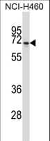 Polyclonal Rabbit anti-Human NPFF2 / NPFFR2 Antibody (aa3-32, WB)