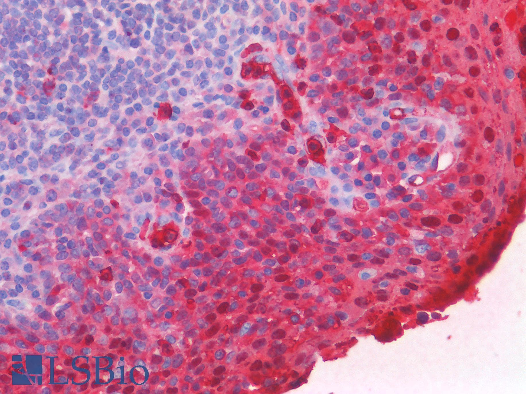 IHC-plus™ Polyclonal Goat anti-Human S100A8 / MRP8 Antibody (aa49-62, IHC, WB)