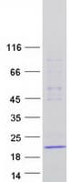 Human DNAL1 Protein (Recombinant Myc-DDK (Flag))