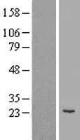 COPS8 / COP9 Protein (Over-Expression Lysate Myc-DDK (Flag))