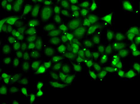 PDCD5 Antibody