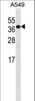 HOXD4 Antibody (aa195-223)