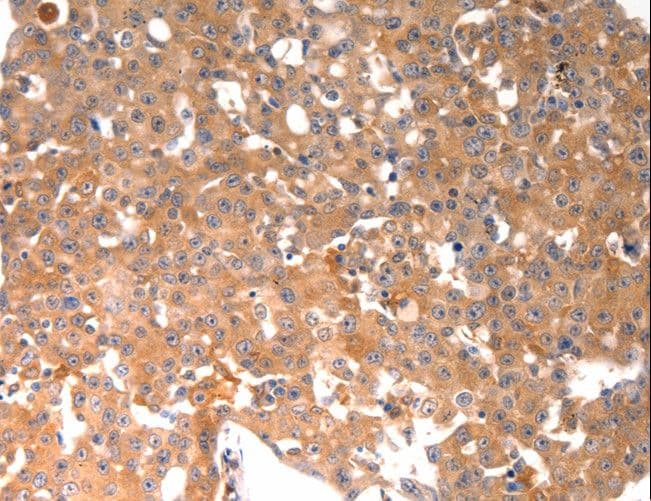 Osteocalcin Antibody