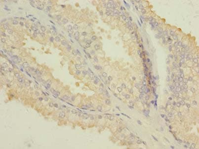 PIK3R1 / p85 Alpha Antibody