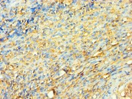 Polyclonal Rabbit anti-Human XRCC5 / Ku80 Antibody (aa543-732, IHC, WB)