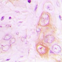 RAB20 Antibody (Internal)