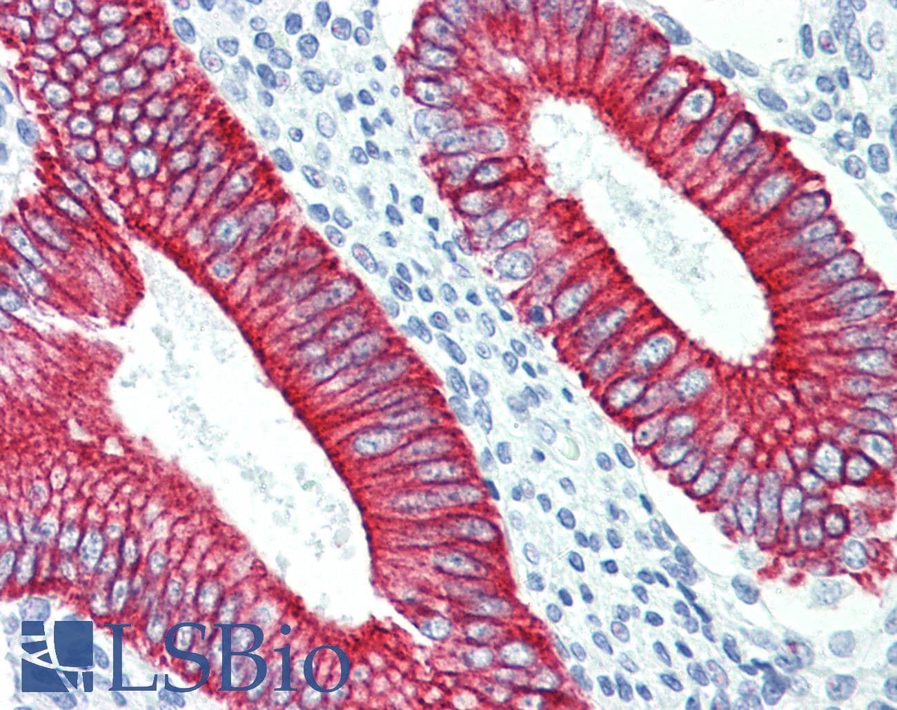 KRT19 / CK19 / Cytokeratin 19 Antibody (DY488)