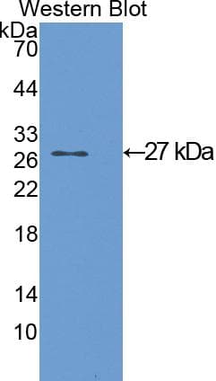 GSTA1 Antibody (aa2-223, FITC)