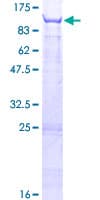 Human TRMT1 Protein (Recombinant GST)