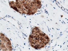AK5 / Adenylate Kinase 5 Antibody (clone OTI2F9)