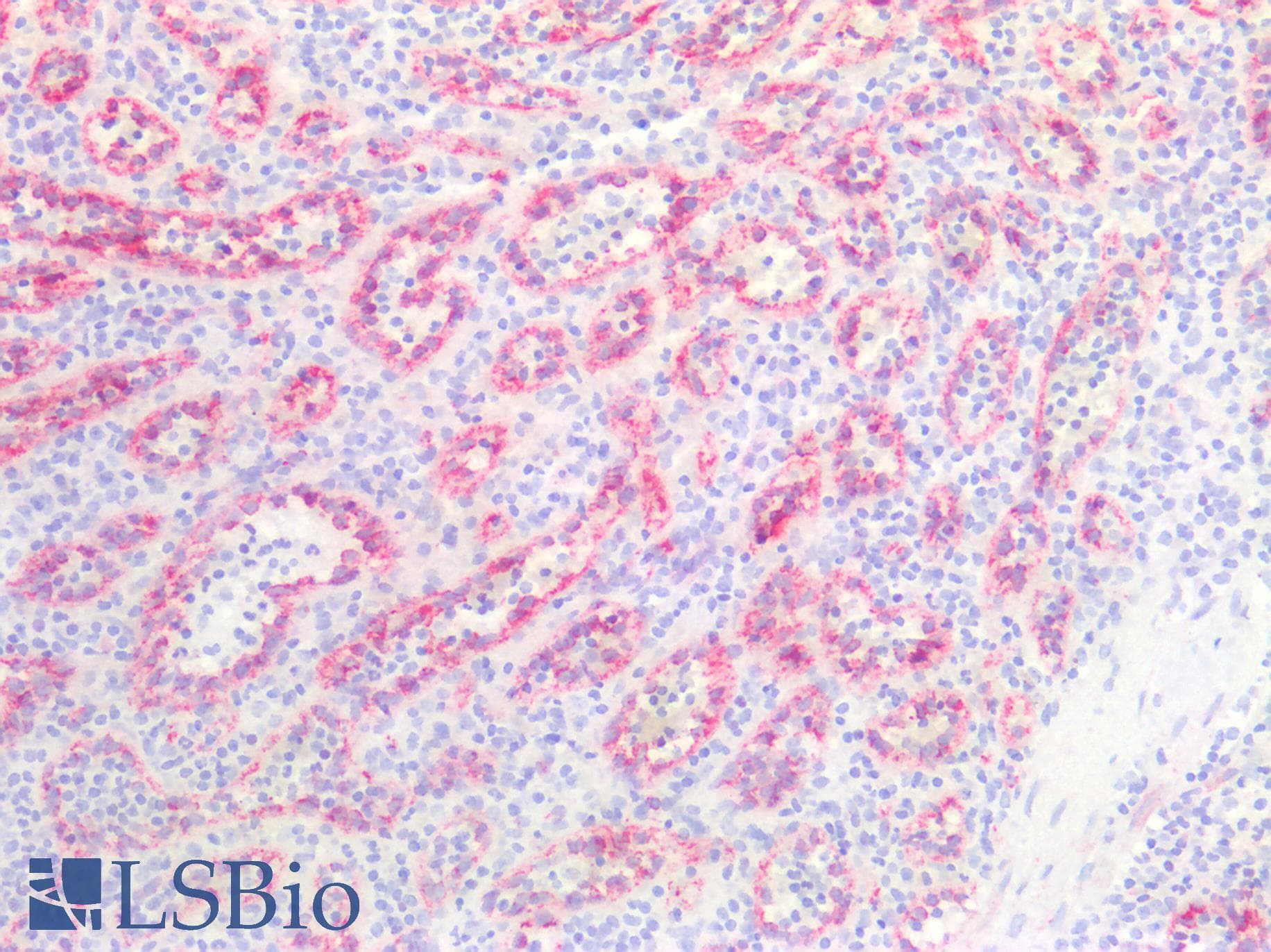 IHC-plus™ CAV1 / Caveolin 1 Antibody