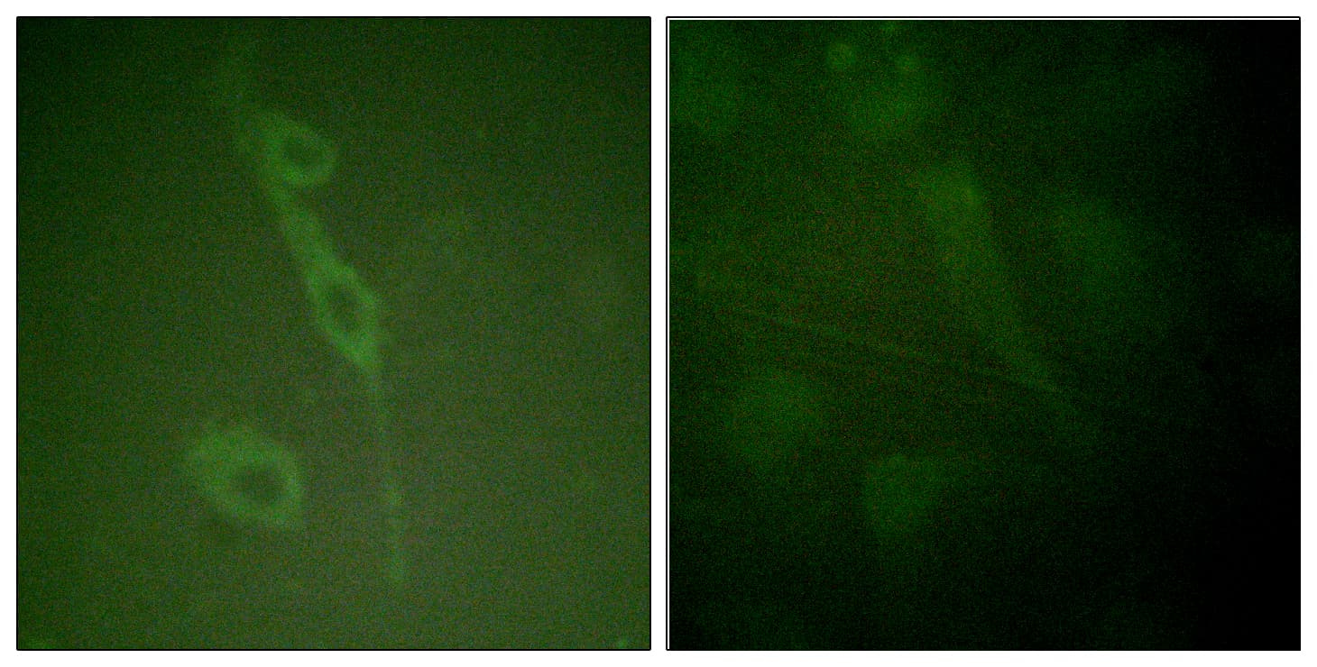 IL7R / CD127 Antibody (phospho-Tyr449)
