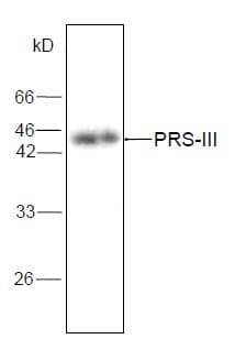 PRPS1L1 Antibody