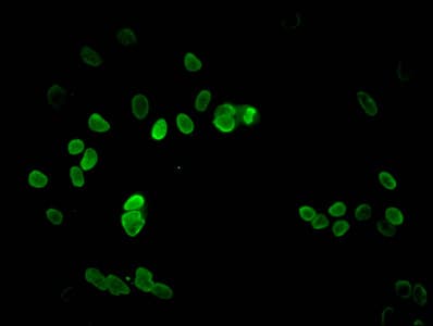 Polyclonal Rabbit anti-Human HIST1H3A Antibody (IF, WB)