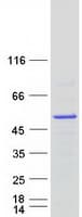 Human HNRNPH2 / hnRNP H2 Protein (Recombinant Myc-DDK (Flag))