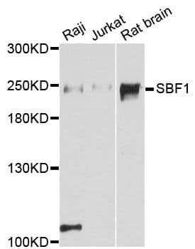 SBF1 / MTMR5 Antibody