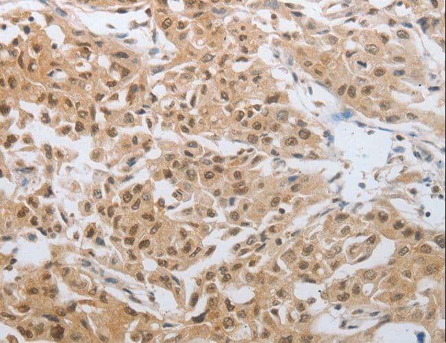 DNAJC7 Antibody