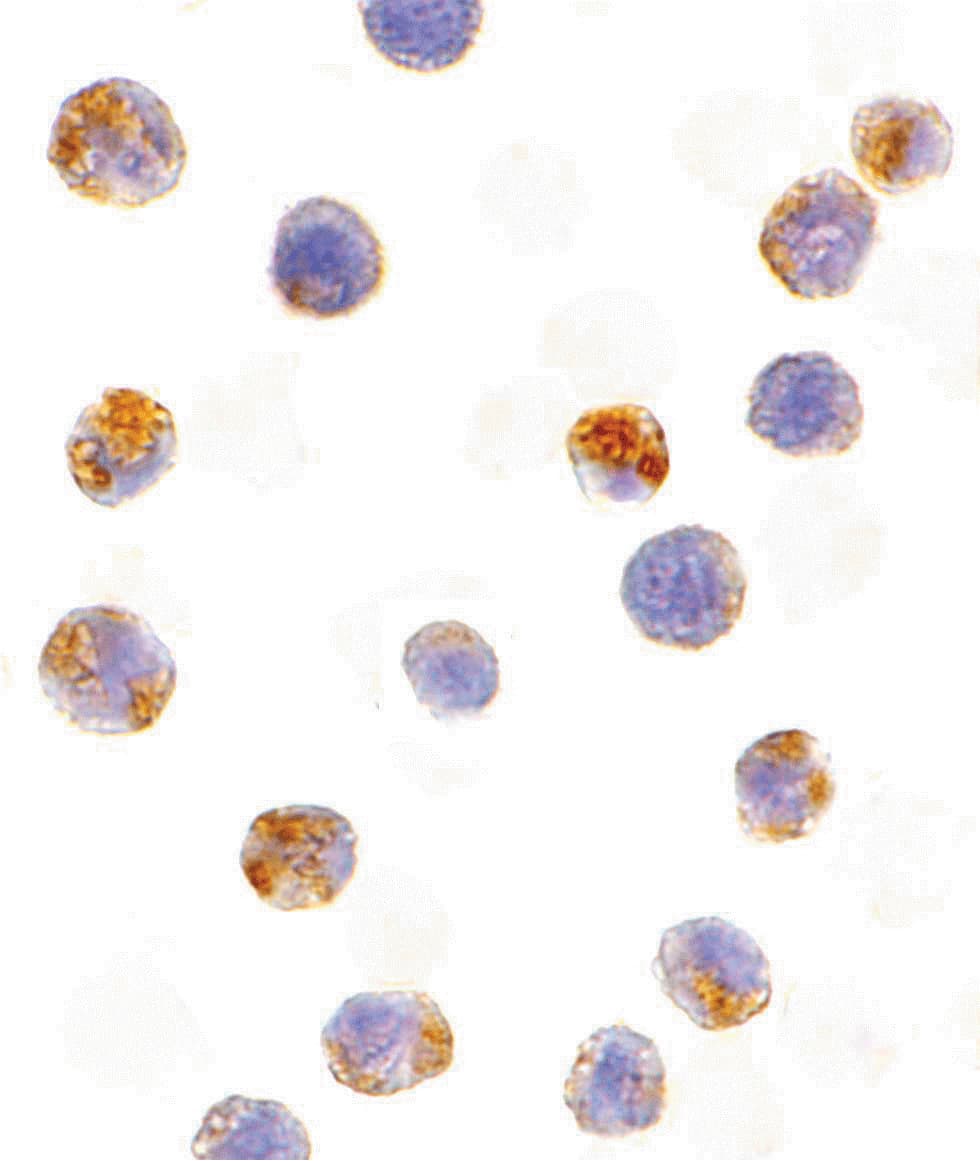 IHC-plus™ AICDA / AID Antibody