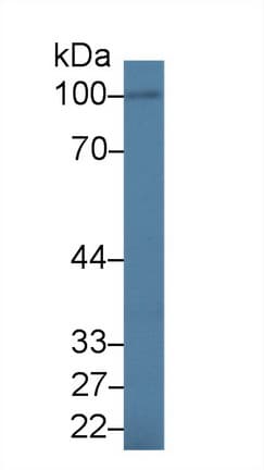 IL17RA Antibody (aa377-534)
