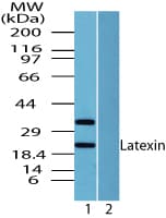 IHC-plus™ Latexin / MUM Antibody (aa200-250)
