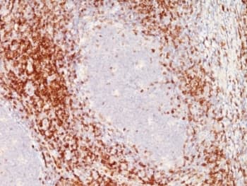 CD6 Antibody (clone SPM547)