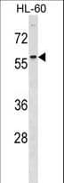 Polyclonal Rabbit anti-Human DCDC2 Antibody (aa306-334, WB)
