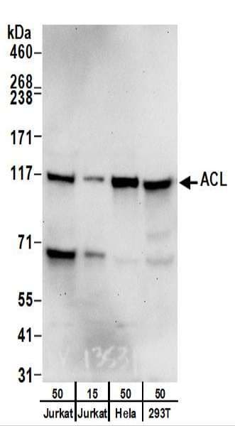 ACLY / ATP Citrate Lyase Antibody (aa1051-1101)